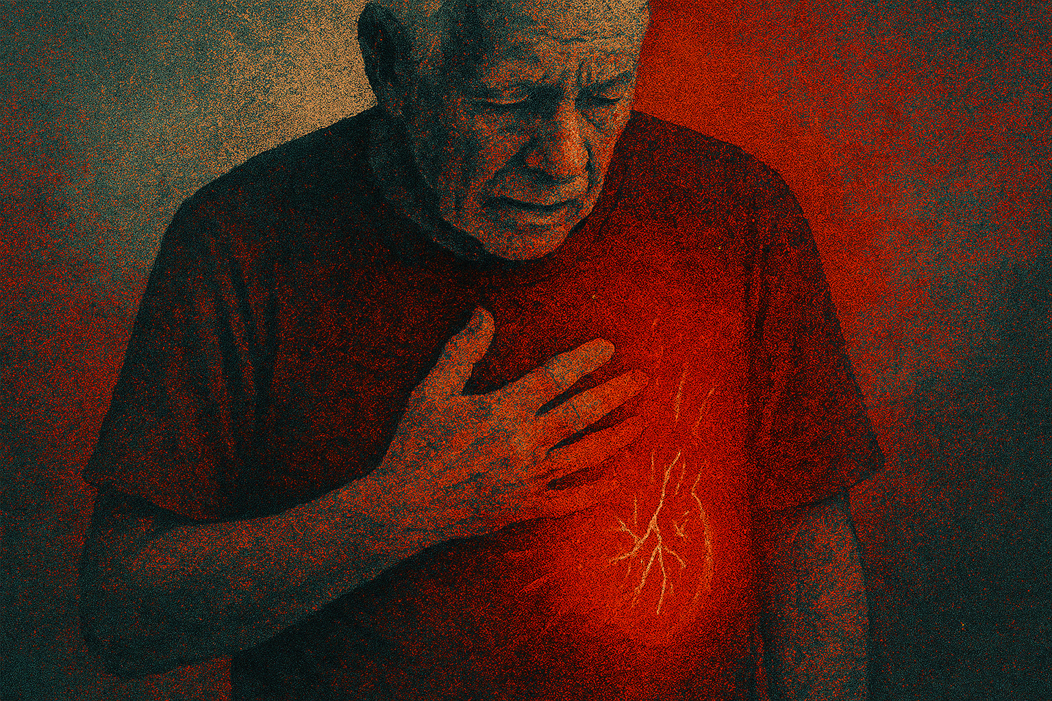 Study for Chronic Heart Failure